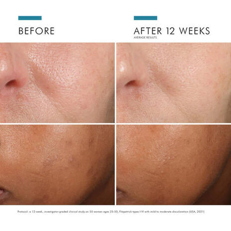 SkinCeuticals Phloretin CF Serum (Combination Skin)