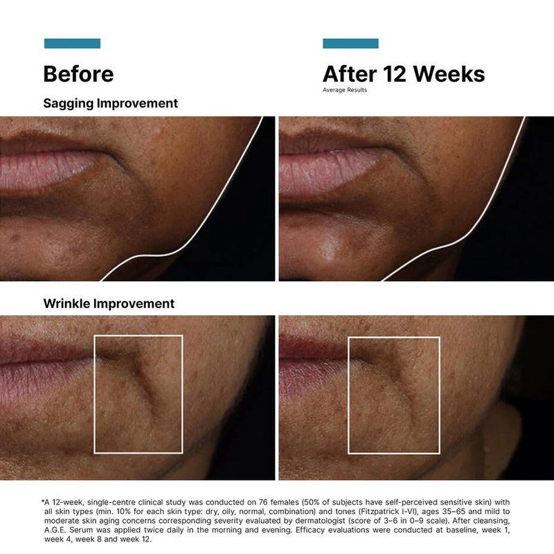 SkinCeuticals AGE Interrupter Ultra Serum