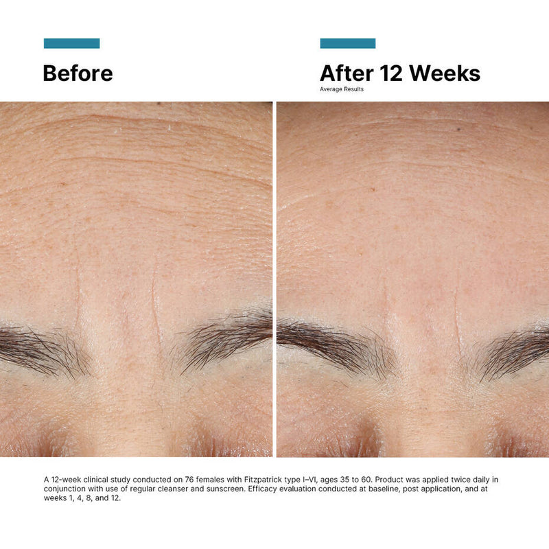 SkinCeuticals Advanced RGN-6