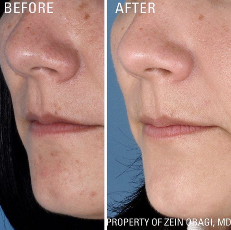 ZO Skin Health Instant Pore Refiner